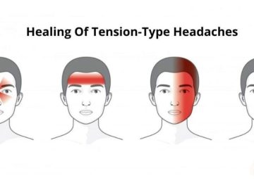Healing Of Tension-Type Headaches At The Best Nursing Home